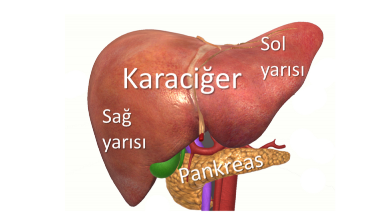 Klatskin Tümörü | Kolanjiyokarsinom (Safra Yolu Kanseri)